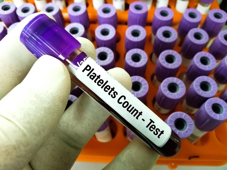platelet count test